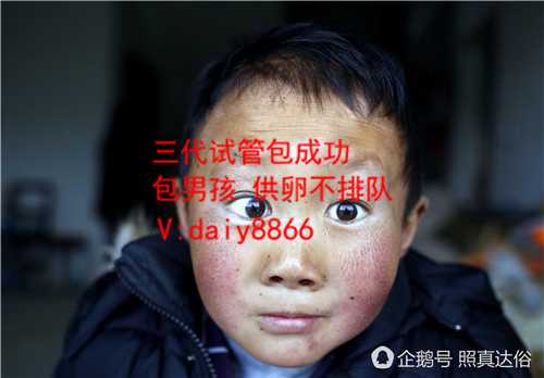 上海借卵中心_海外三代试管婴儿：染色体异常会面临哪些生育难题